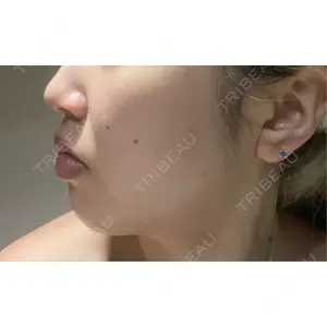 L‘amour clinic Tokyo【ラムールクリニック東京】口コミ