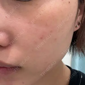 ルラ美容クリニック ルラ美容クリニック 池袋院口コミ