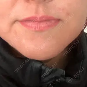 新未来クリニック口コミ