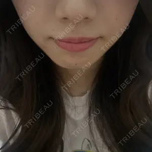 TAクリニック 福岡TAクリニック口コミ