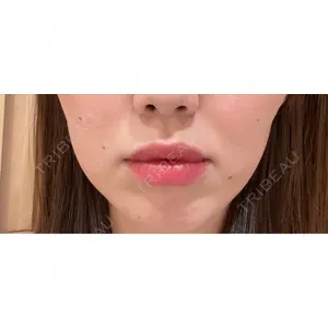 AYANAフィラーズクリニック AYANAフィラーズクリニック 渋谷院口コミ