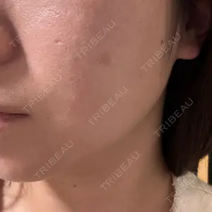 BITO BEAUTY CLINIC BITO BEAUTY CLINIC口コミ