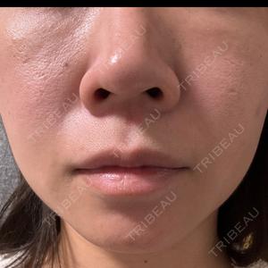 BITO BEAUTY CLINIC BITO BEAUTY CLINIC口コミ