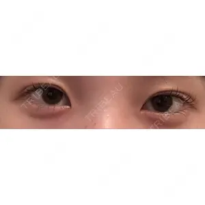 口コミ