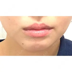 TAクリニック 福岡TAクリニック口コミ