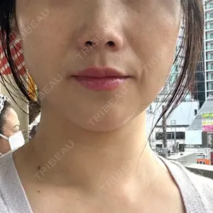 ゆきスキンクリニック 東池袋口コミ