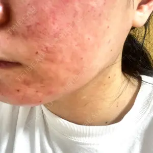 MIO CLINIC 梅田院口コミ