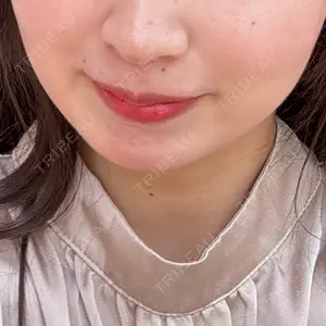 TCB東京中央美容外科 TCB東京中央美容外科 銀座有楽町院口コミ