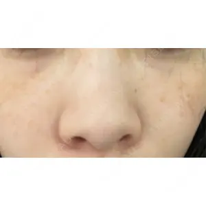 L‘amour clinic Tokyo【ラムールクリニック東京】口コミ