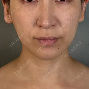 アリエル美容クリニック アリエル美容クリニック 大宮院口コミ