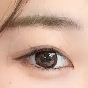 銀座美容外科クリニック 銀座美容外科クリニック 銀座院口コミ