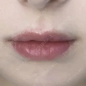 口コミ