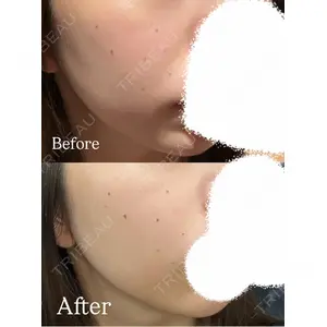 口コミ