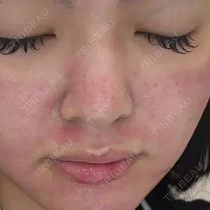 ルラ美容クリニック ルラ美容クリニック 広島院口コミ