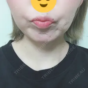 口コミ