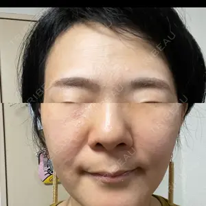 ルラ美容クリニック ルラ美容クリニック 静岡院口コミ