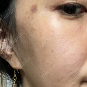 ルラ美容クリニック ルラ美容クリニック 静岡院口コミ