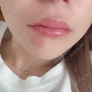 口コミ