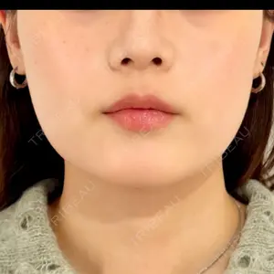 gift clinic口コミ