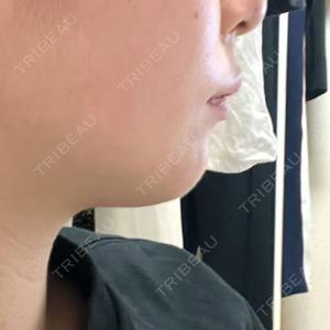 TCB東京中央美容外科 TCB東京中央美容外科 静岡院口コミ