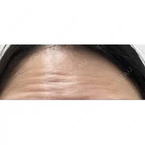 TCB東京中央美容外科 TCB東京中央美容外科 名古屋栄院口コミ