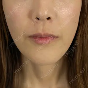藤・ナチュレ美容クリニック 藤・ナチュレ美容クリニック 銀座院口コミ