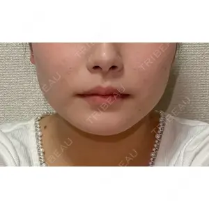 口コミ