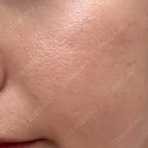 東京シルククリニック 東京シルククリニック 東京神田院口コミ