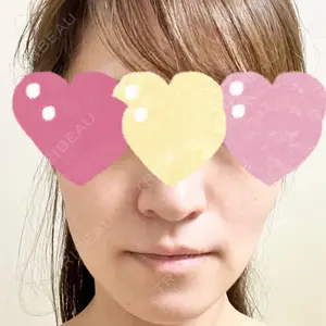 PureMe Skin Clinic（ピュアミースキンクリニック麻布）口コミ