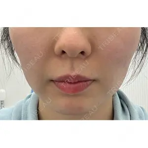 TCB東京中央美容外科 TCB東京中央美容外科 銀座有楽町院口コミ