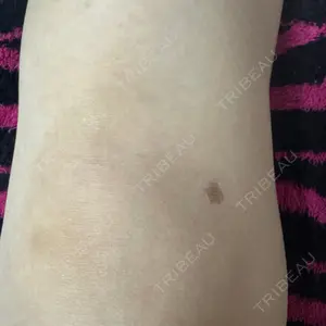 下北沢スキンクリニックの口コミ