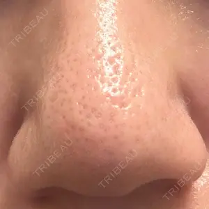 東京シルククリニック 東京シルククリニック 東京神田院口コミ