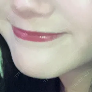 銀座美容外科クリニック 銀座美容外科クリニック 銀座院口コミ