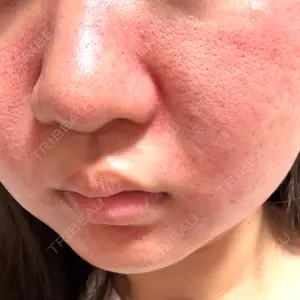 東京シルククリニック 東京シルククリニック 東京神田院口コミ