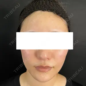 藤・ナチュレ美容クリニック 藤・ナチュレ美容クリニック 銀座院口コミ