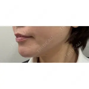 ルラ美容クリニック ルラ美容クリニック 広島院口コミ