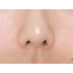 東京素肌クリニックの口コミ
