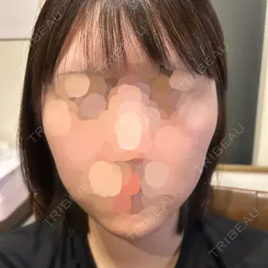 ルラ美容クリニック ルラ美容クリニック 札幌院口コミ