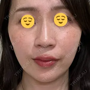 口コミ