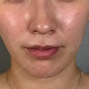 アリエル美容クリニック アリエル美容クリニック 大宮院口コミ