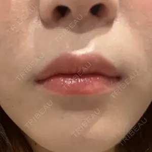 口コミ