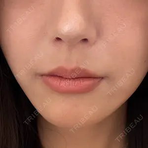 DMTC CLINIC DMTC美容皮膚科 大宮院口コミ