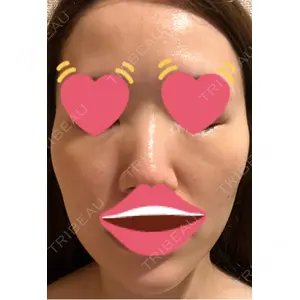 メディカルエピレーションクリニック メディカルエピレーションクリニック 心斎橋院口コミ