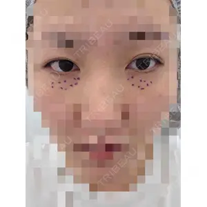 TCB東京中央美容外科 TCB東京中央美容外科 高崎院口コミ