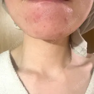 RAISE CLINIC 【レイズクリニック】口コミ