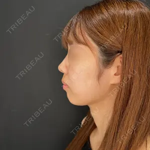 HAAB×DREAM BEAUTY CLINIC HAAB×DREAM BEAUTY CLINIC 大阪梅田院口コミ