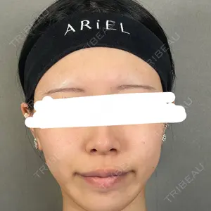 アリエル美容クリニック アリエル美容クリニック 大宮院口コミ