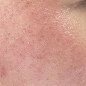 ルラ美容クリニック ルラ美容クリニック 大宮院 / ルラスキンクリニック 大宮院口コミ