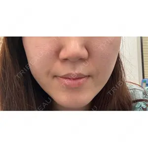 東京シルククリニック 東京シルククリニック 東京神田院口コミ