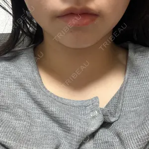 口コミ